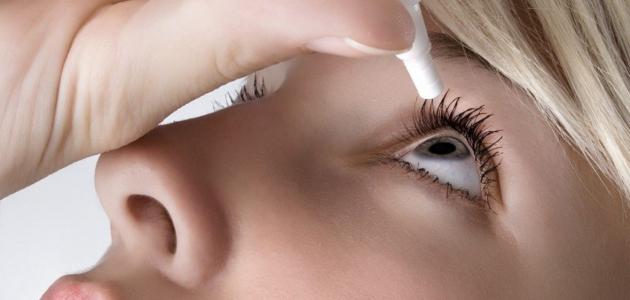 اسباب حساسية العين والعلاج