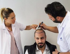 ضمان زراعة الشعر في تركيا
